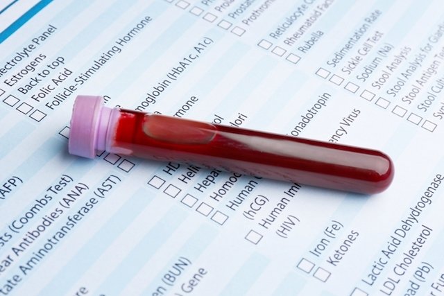 GGT Blood Test: What a High or Low Result Means - Tua Saúde